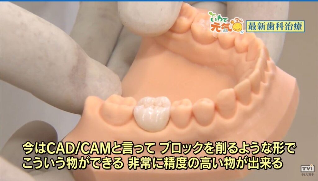 先端治療の歯医者｜TVいわて